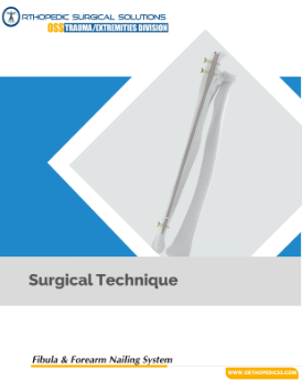 Fibula and forearm intramedullary nails