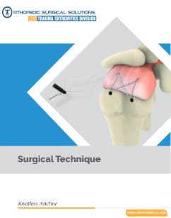 A picture of an image with the words surgical technique.