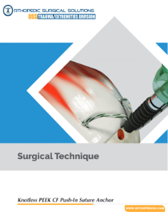 Knotless PEEK push-in suture anchor
