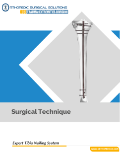 Expert tibia nailing system illustration