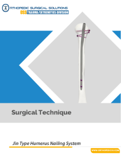 Jin humerus nail technique diagram