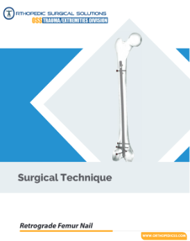 Retrograde femur nail implant drawing