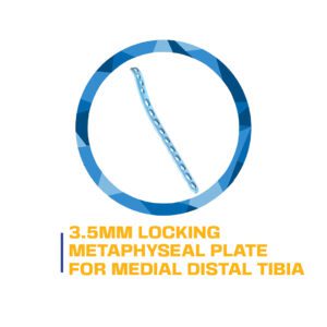 3.5mm locking plate for medial distal tibia.