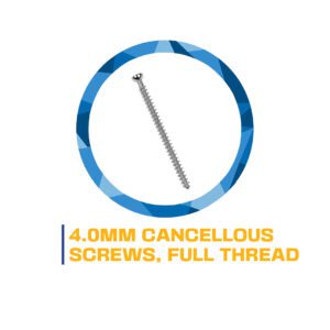 4.0mm cancellous screw, full thread.