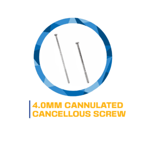 4.0mm cannulated cancellous screws.