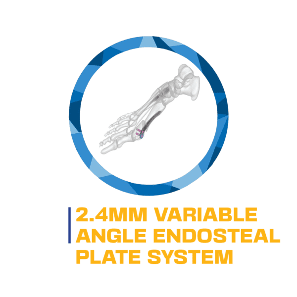 2.4mm Variable Angle Distal Radius Low Profile Plate System - Orthopedic SS